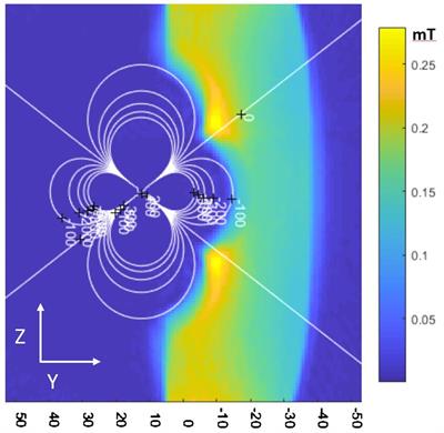 Balanced-force shim system for correcting magnetic-field inhomogeneities in the heart due to implanted cardioverter defibrillators